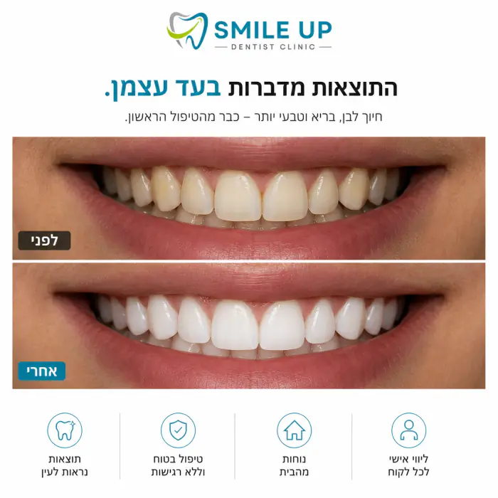 המחשה של תוצאות לפני ואחרי הלבנת שיניים